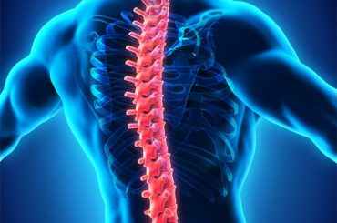 IRM coloana vertebrală